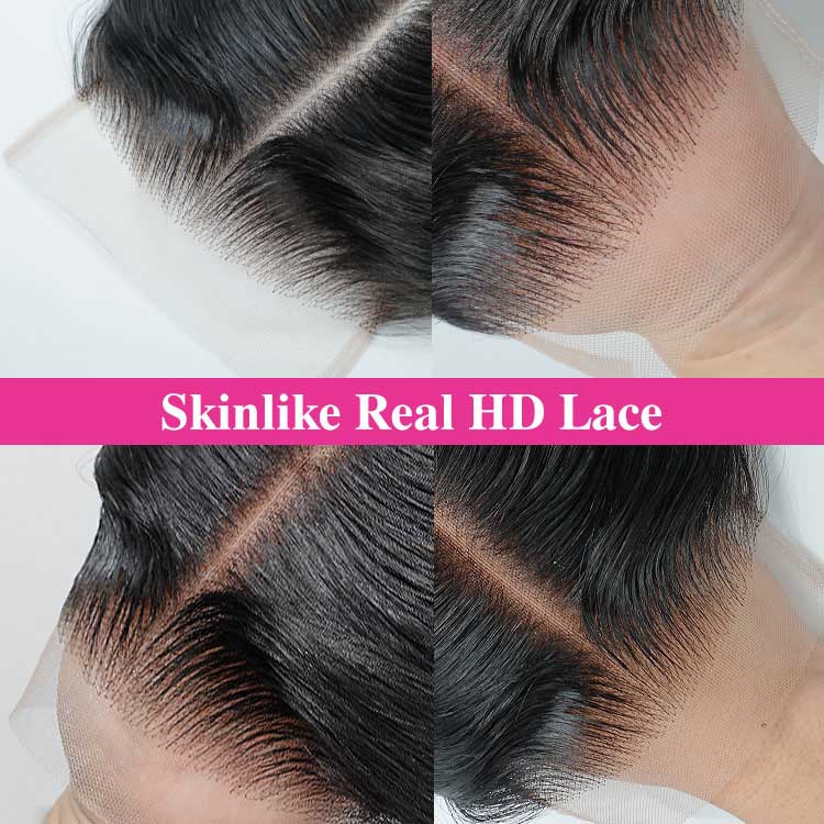 loose deep closure with bundles