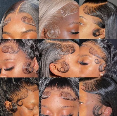 Normal hairline