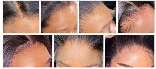 Easy To Install & Affordable Glueless 5x5 Lace Closure Wigs