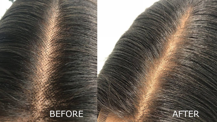 How to Melt Lace Closure Without Glue?
